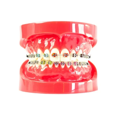 Home | Buy Now At Evodent Evodent orthodontic patient education model with metal braces - red