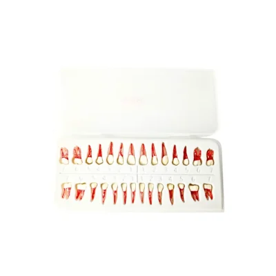 Evodent Atlas Root Canal Replacement Fullset Teeth